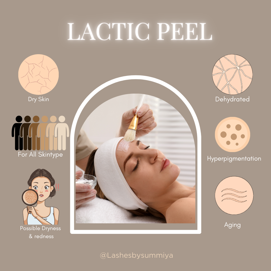 30% Lactic Peel