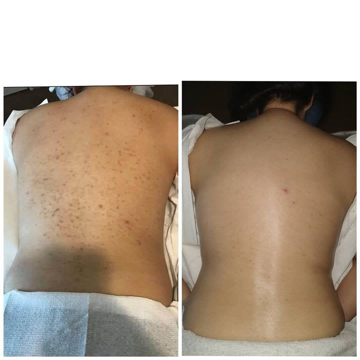 Bare back Bliss