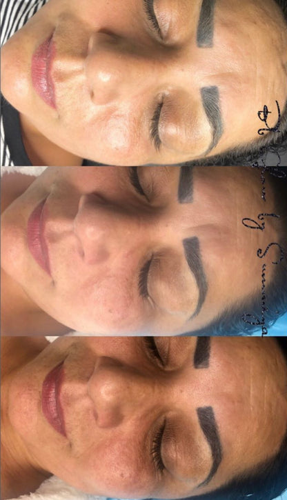 BB Glow Treatment with LED light therapy